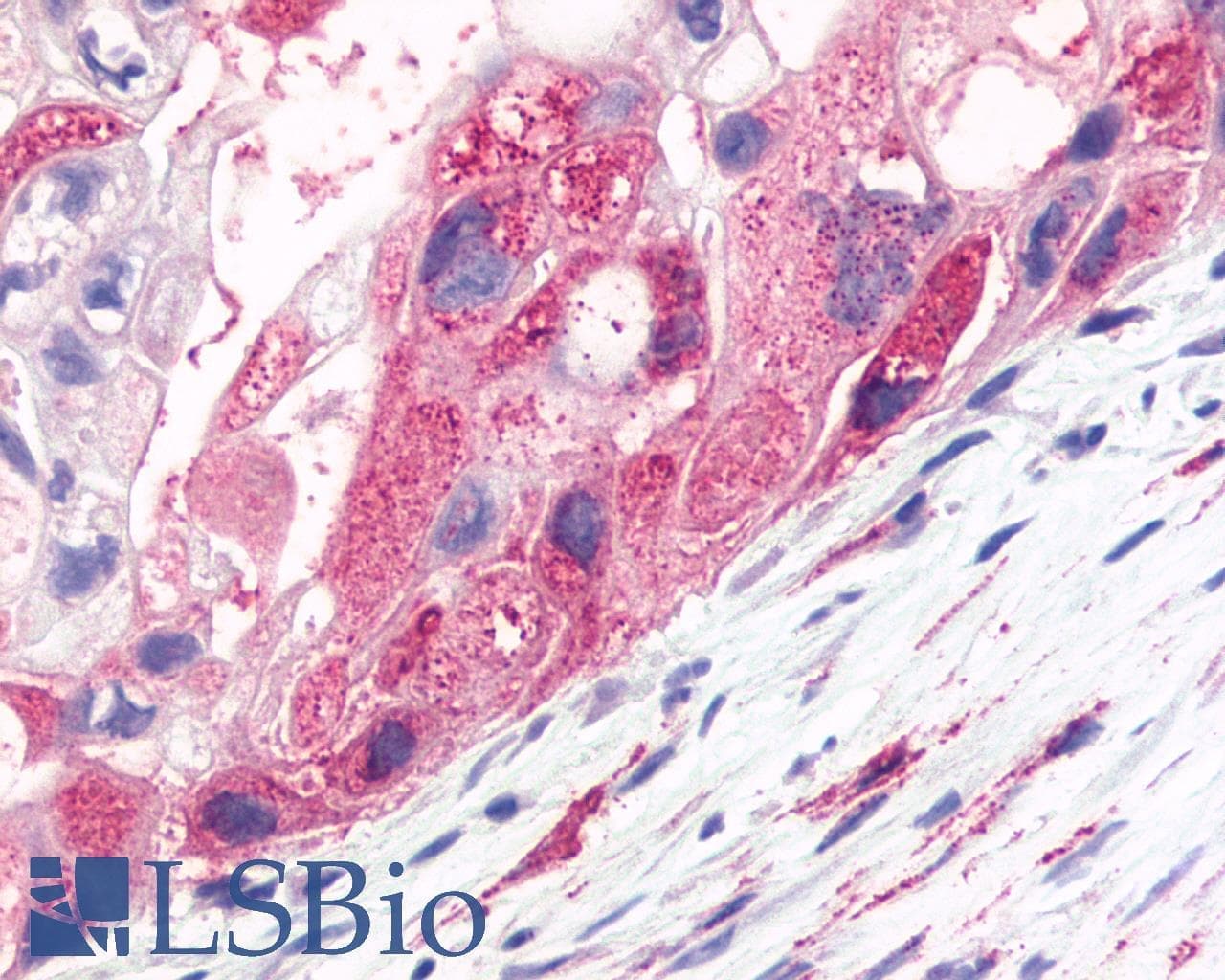 IHC-plus™ FZD2 / Frizzled 2 Antibody (Extracellular Domain)