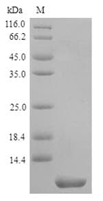 Human TM4SF1 Protein (Recombinant 6His, N-terminus)