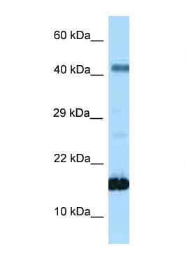 SST / Somatostatin Antibody (aa35-84)