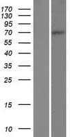 ABLIM2 Protein (Over-Expression Lysate Myc-DDK (Flag))