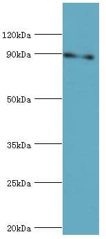 Polyclonal Rabbit anti-Human STAT5B Antibody (aa40-280, IHC, WB)