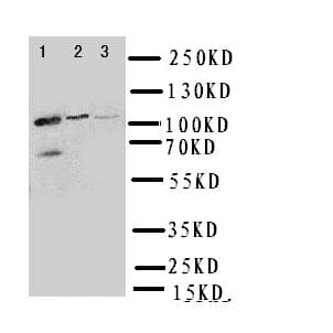 PPP1R12A / MYPT1 Antibody (aa1-17)