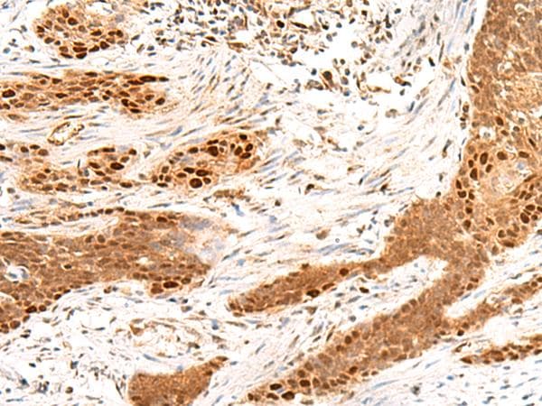MKX Antibody