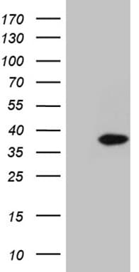 C1orf111 Antibody (clone OTI2F3)