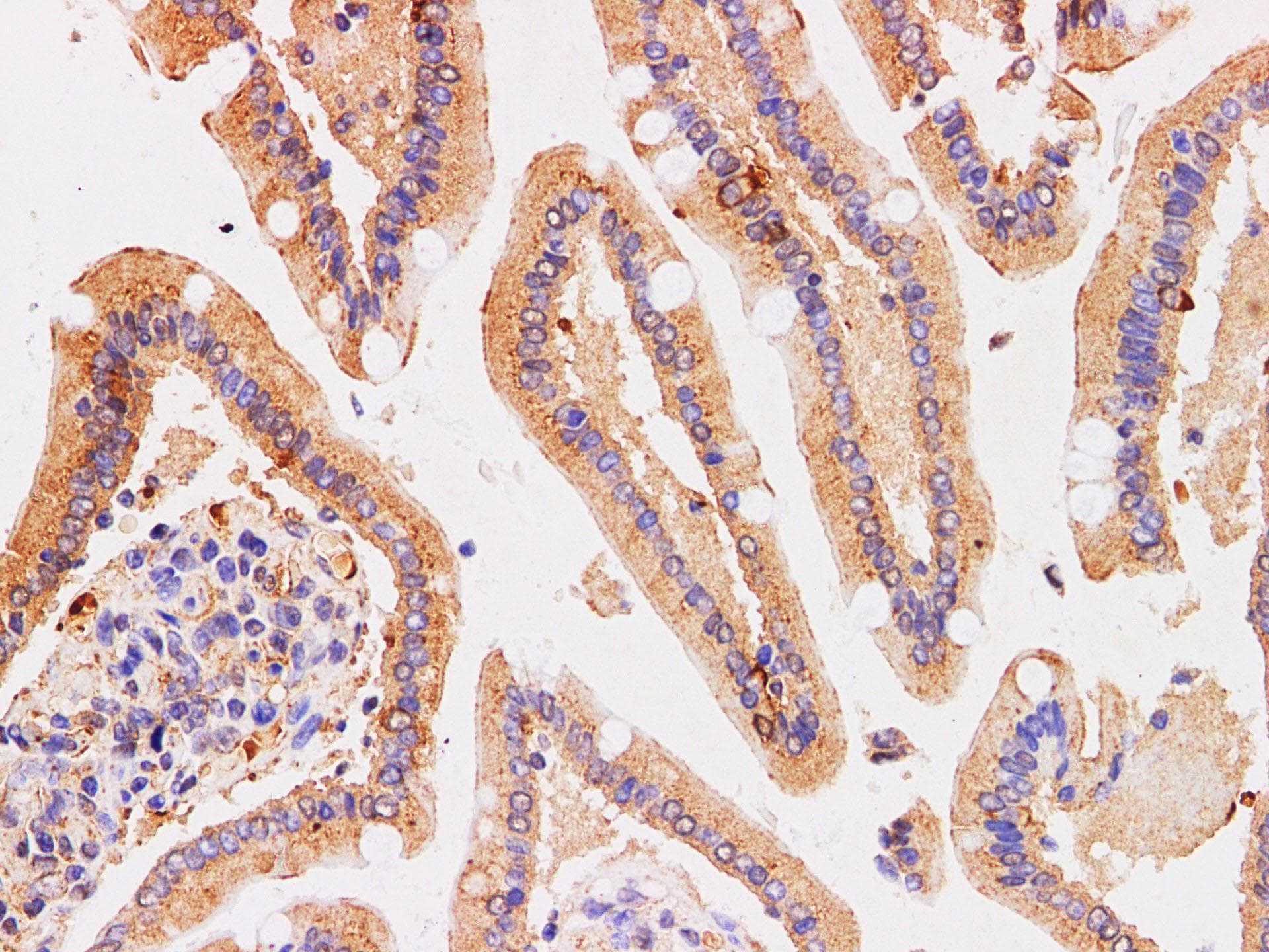 CHGA / Chromogranin A Antibody