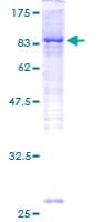 Human IRAK3 / IRAKM / IRAK-M Protein (Recombinant GST)