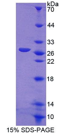 Human CRMP1 Protein (Recombinant His-T7)