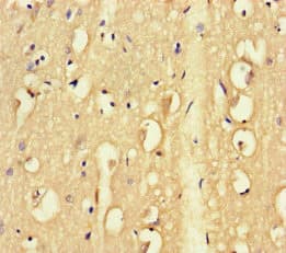 FAM46C Antibody