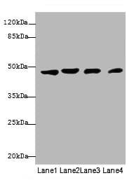 KRT18 / CK18 / Cytokeratin 18 Antibody