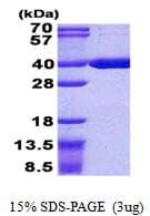 Human ACOT8 Protein (Recombinant His)