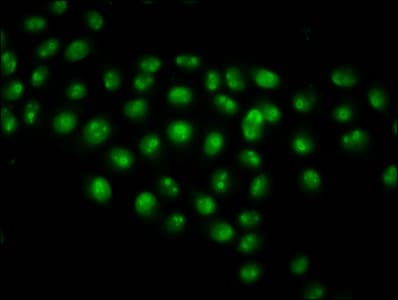 HIST1H2AI Antibody