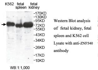 Polyclonal Rabbit anti-Human ZNF540 Antibody (aa250-539, IHC, WB)