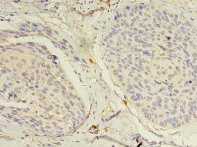 Polyclonal Rabbit anti-Human TSC501 / NAT8 Antibody (IHC)