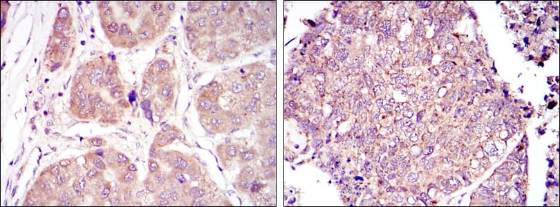 HIF1A / HIF1 Alpha Antibody (clone 1A3)
