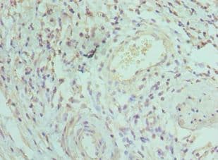 Polyclonal Rabbit anti-Human IRAK3 / IRAKM / IRAK-M Antibody (aa367-596, IHC)