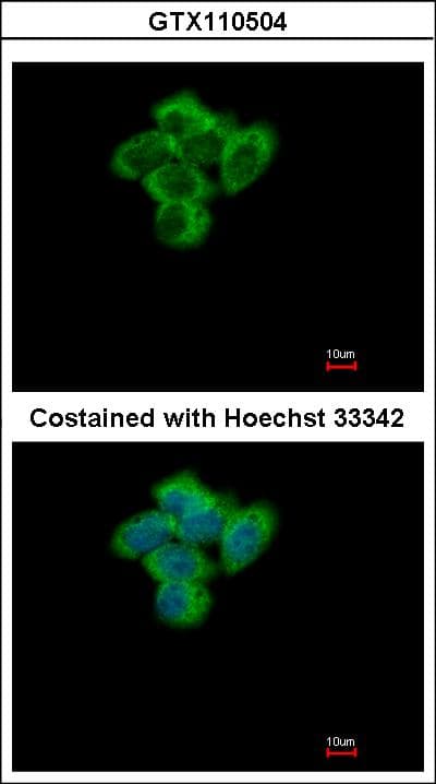 SENP2 Antibody (aa1-62)