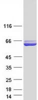 Human P5CDH / ALDH4A1 Protein (Recombinant Myc-DDK (Flag))