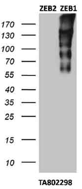 ZEB1 / AREB6 Antibody (aa1-350, clone OTI3G6)