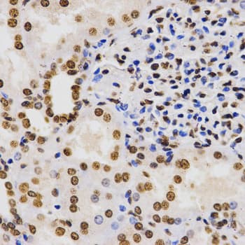 Histone H3 Antibody (Tri-Methyl-Lys9)