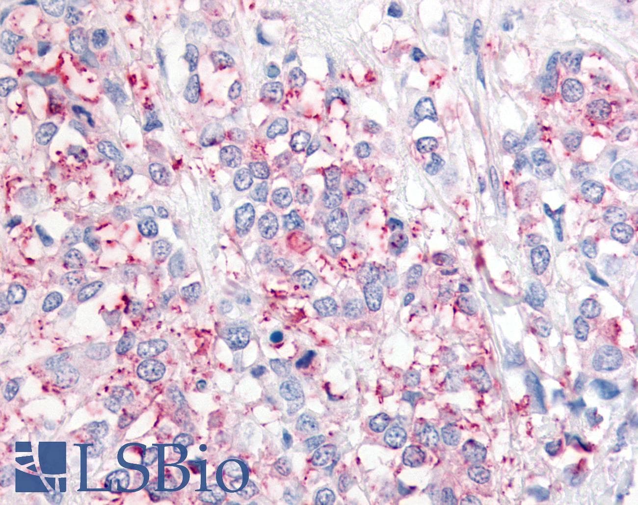 PathPlus™ USP20 / VDU2 Antibody (Internal)