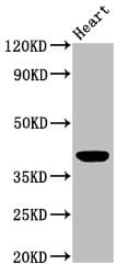 IHC-plus™ LGALS9 / Galectin 9 Antibody (aa1-323)