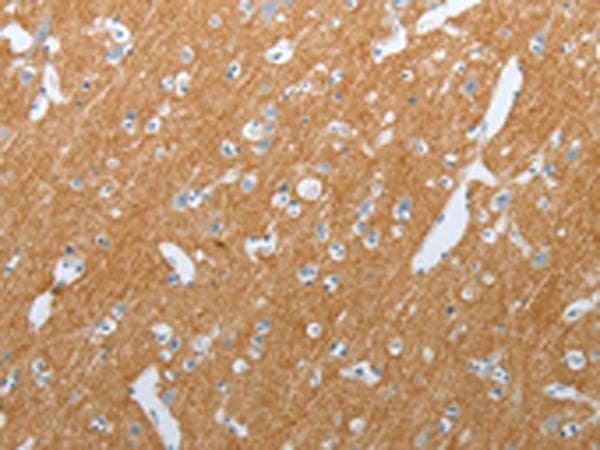 SLC17A7 / VGLUT1 Antibody