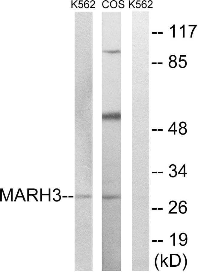 Polyclonal Rabbit anti-Human MARCH3 Antibody (IHC, WB)