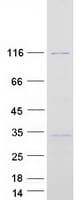 Human GTF3C2 Protein (Recombinant Myc-DDK (Flag))