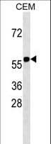 Polyclonal Rabbit anti-Human RNF31 Antibody (aa955-983, WB)