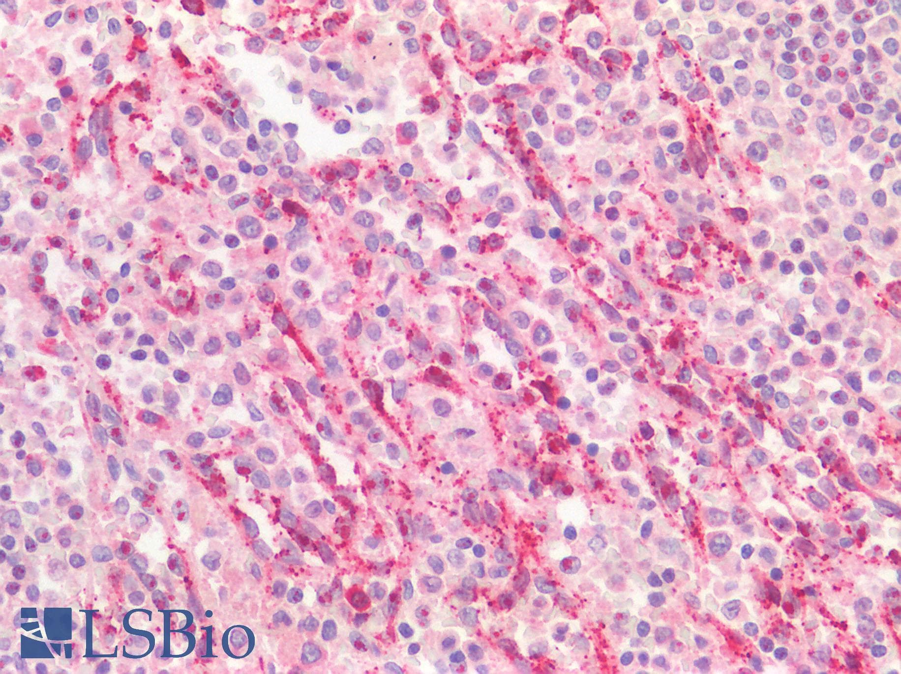 IHC-plus™ IFIH1 / MDA5 Antibody