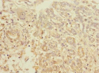 TIGD7 Antibody