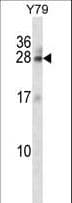 RAB3A Antibody (aa1-30)