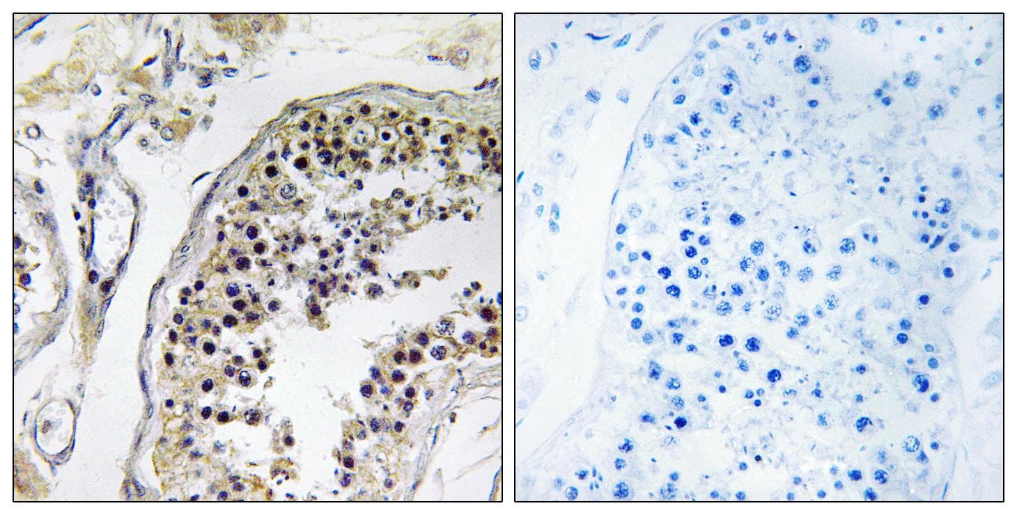 CNOT4 / CLONE243 Antibody