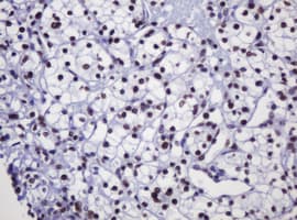 DCPS Antibody (clone OTI4H8)