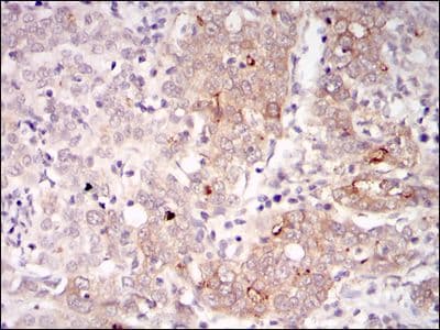 BLNK Antibody (clone 5G9)