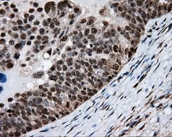 HMRF1L / MTRF1L Antibody (clone OTI1E3)