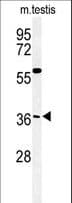 CCDC92 Antibody (aa177-205)