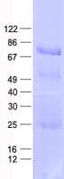 Human GNPAT / DHAP-AT Protein (Recombinant His, N-Terminal)