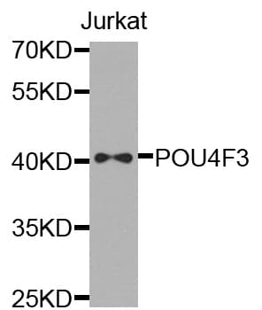 POU4F3 / BRN3C Antibody