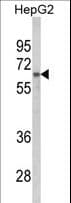 HNRNPL / hnRNP L Antibody (aa461-490)