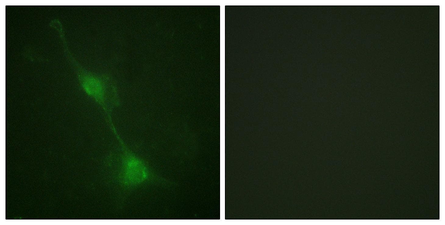 ATXN1 / SCA1 Antibody