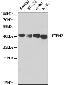 PTPN2 / TC-PTP Antibody