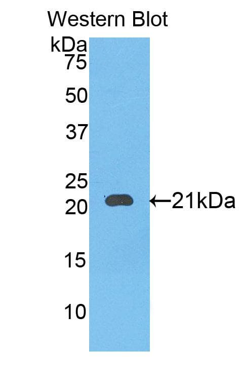 SERPINB4 / SCCA1+2 Antibody (aa60-222)