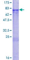 Human TBX6 Protein (Recombinant GST)