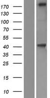 KIF21B Protein (Over-Expression Lysate Myc-DDK (Flag))