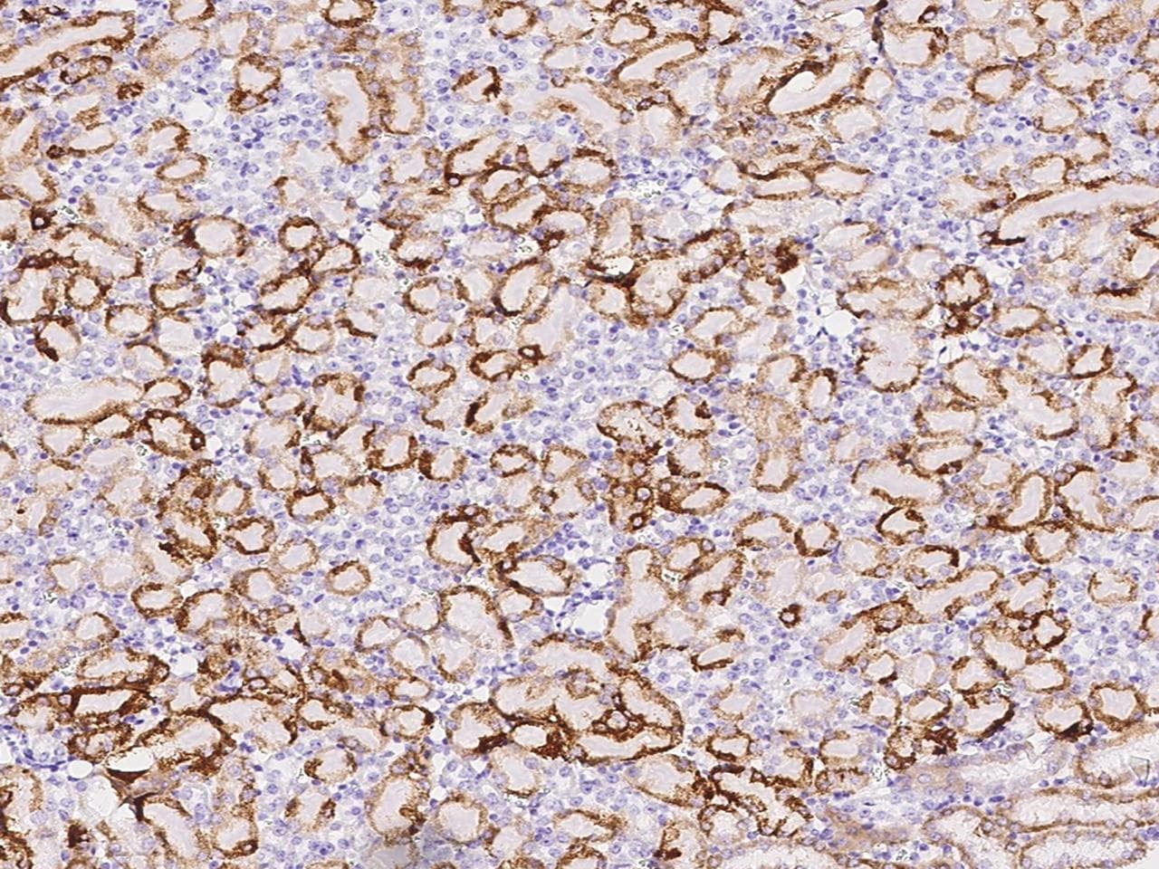 PXN / Paxillin Antibody (Preservative Free)