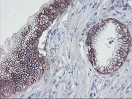 Monoclonal Mouse anti-Human ALOX15 / 15-Lipoxygenase Antibody (clone OTI3G8, IHC, IF, WB)