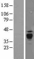Human PPT1 / CLN1 Protein (Over-Expression Lysate Myc-DDK (Flag))