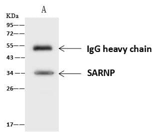 SARNP / Hcc-1 / CIP29 Antibody