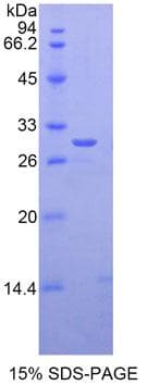 Human GLI3 Protein (Recombinant His-T7)
